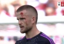 Kluczowy obrońca Bayernu ryzykuje, że opuści rewanżowy mecz z Realem Madryt